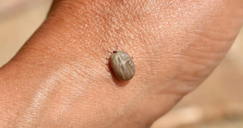 A close-up of a tick attached to the skin of a hand.