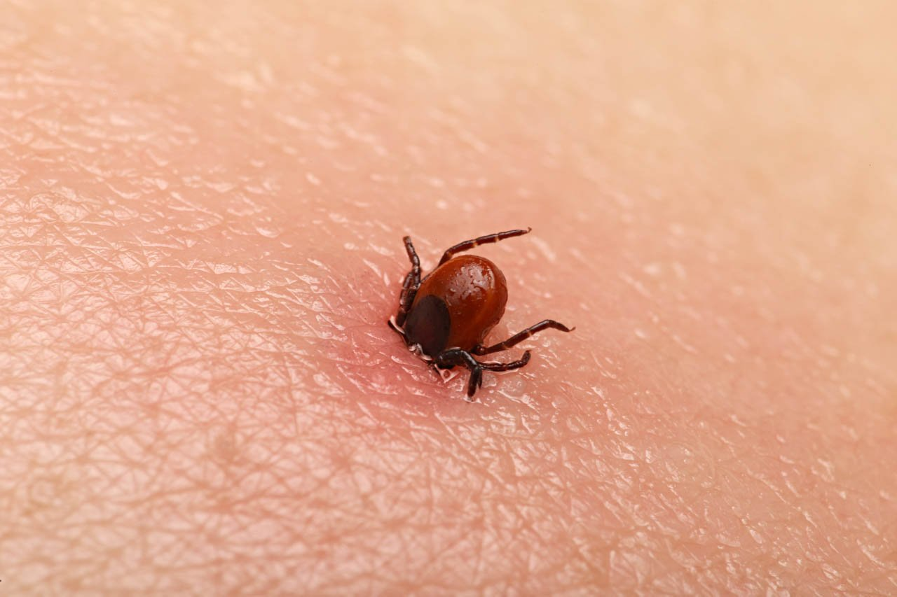 Close-up of a tick on skin.