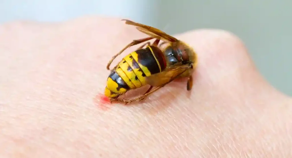 Hornet stinging a person’s hand.